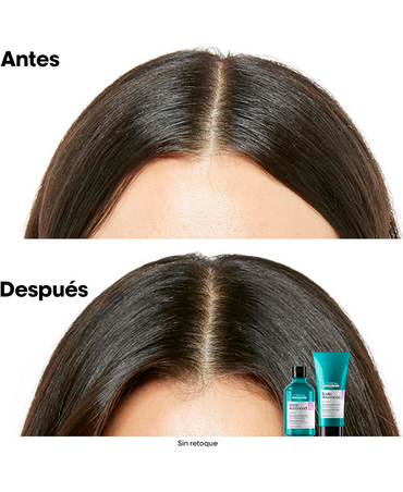 LP LOREAL SERIE EXPERT SCALP ADVANCED ANTI SENSITIVE SHAMPOO 300 ML.2026