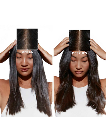 KERASTASE SYMBIOSE MASQUE DANDRUFF CASPA 200 ML.