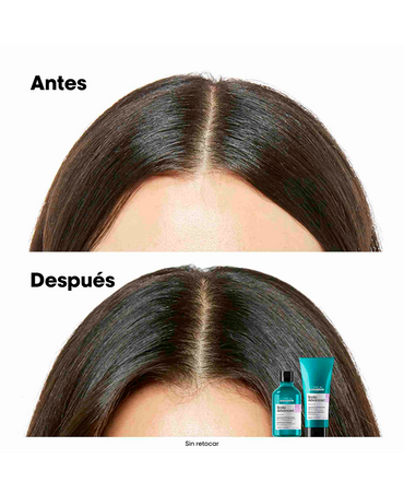 LP LOREAL SERIE EXPERT SCALP ADVANCE SHAMPOO 500 ML. REFILL - El Palacio De La Belleza