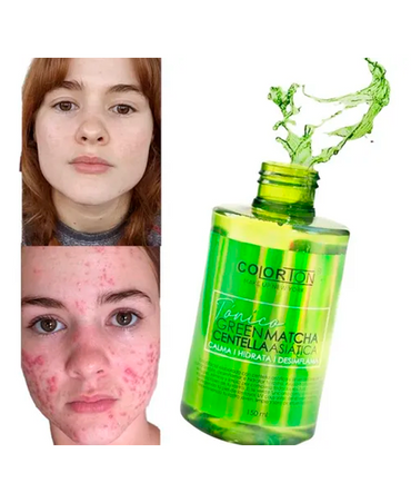 COLORTON TONICO GREEN MATCHA CENTELLA ASIATICA 150 ML.