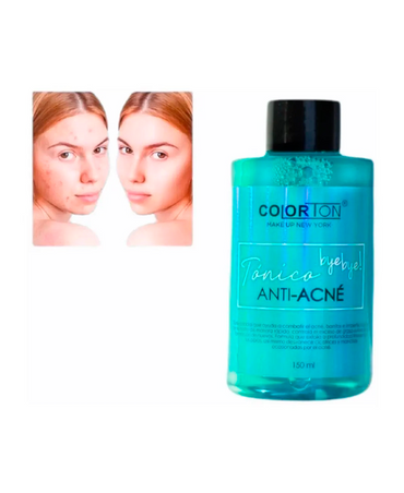 COLORTON TONICO BYE BYE! ANTI-ACNE 150 ML.