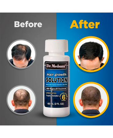DR. MEDSAM MINOXIDIL PARA CABELLO Y BARBA AL 5% 60 ML. - El Palacio De La Belleza