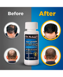 DR. MEDSAM MINOXIDIL PARA CABELLO Y BARBA AL 5% 60 ML. - El Palacio De La Belleza