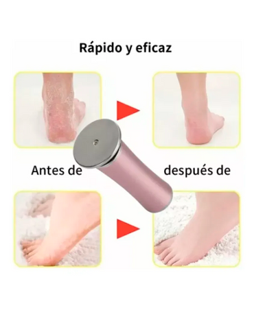 REMOVEDOR CALLOS ELECTRICO RECARGABLE TL-DS03