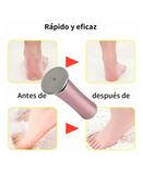 REMOVEDOR CALLOS ELECTRICO RECARGABLE TL-DS03